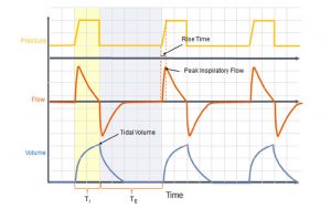 Hình 1 Pressure control ventilation. Máy cung cấp một nhịp thở với áp lực cài đặt trước với dạng sóng lưu lượng hằng định