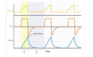 Hình 2 Volume control ventilation. Máy cung cấp một thể tích cài đặt trước với dạng sóng lưu lượng hằng định