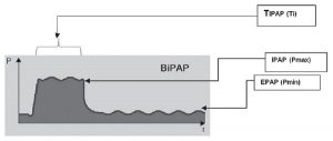 Hình 3: Áp lực/thời gian dạng sóng trong áp lực đường thở hai mức áp lực dương. TIPAP - thời gian áp lực đường thở dương trong thì hít vào; IPAP - Áp lực đường thở dương thì hít vào; EPAP - Áp lực đường thở dương thì thở ra [24]