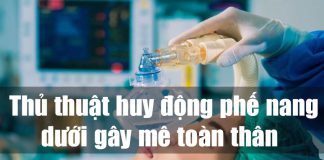 Thủ thuật huy động phế nang dưới gây mê toàn thân