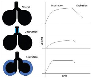Hình 2: Ảnh hưởng của tắc nghẽn và hạn chế đến nhịp thở và thời gian hằng định trong thì hít vào và thở ra (Adapted from West JB, Respiratory Physiology: The essentials, 4th Ed, 2000, Williams and Wilkins)