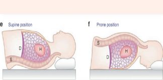 Tư thế nằm sấp