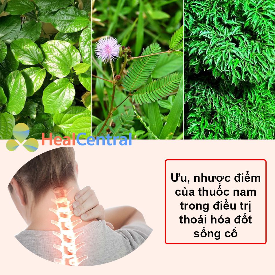 Ưu, nhược điểm của điều trị thoái hóa đốt sống cổ bằng thuốc nam