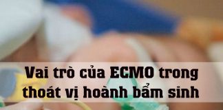 Vai trò của ECMO trong thoát vị hoành bẩm sinh