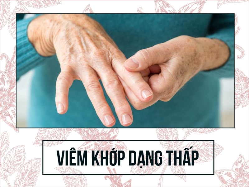 Nhận định chung về bệnh viêm khớp dạng thấp