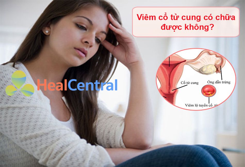 Viêm cổ tử cung có chữa được không?