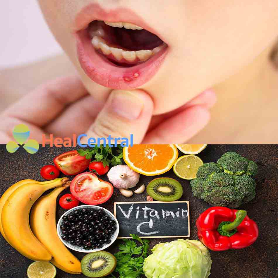 Hoa quả giàu vitamin C