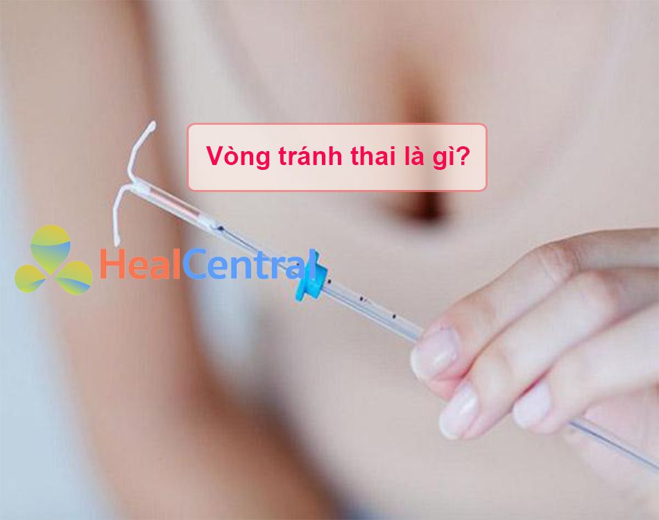 Vòng tránh thai là gì?