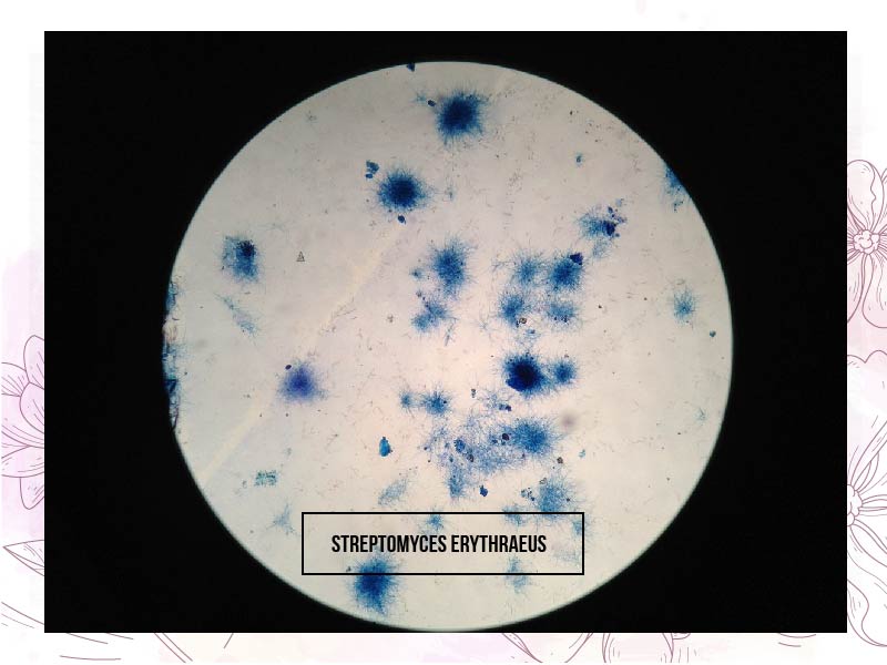 Chủng xạ khuẩn Streptomyces