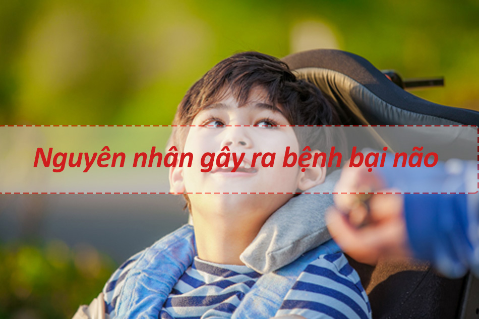 Nguyên nhân gây ra bại não