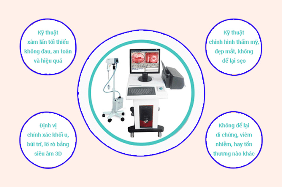 Ưu điểm khi cắt trĩ bằng phương pháp HCPT