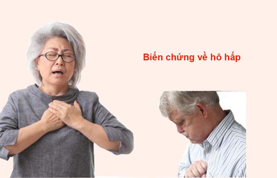 Biến chứng về hô hấp