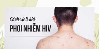 Cách xử lí khi phơi nhiễm HIV