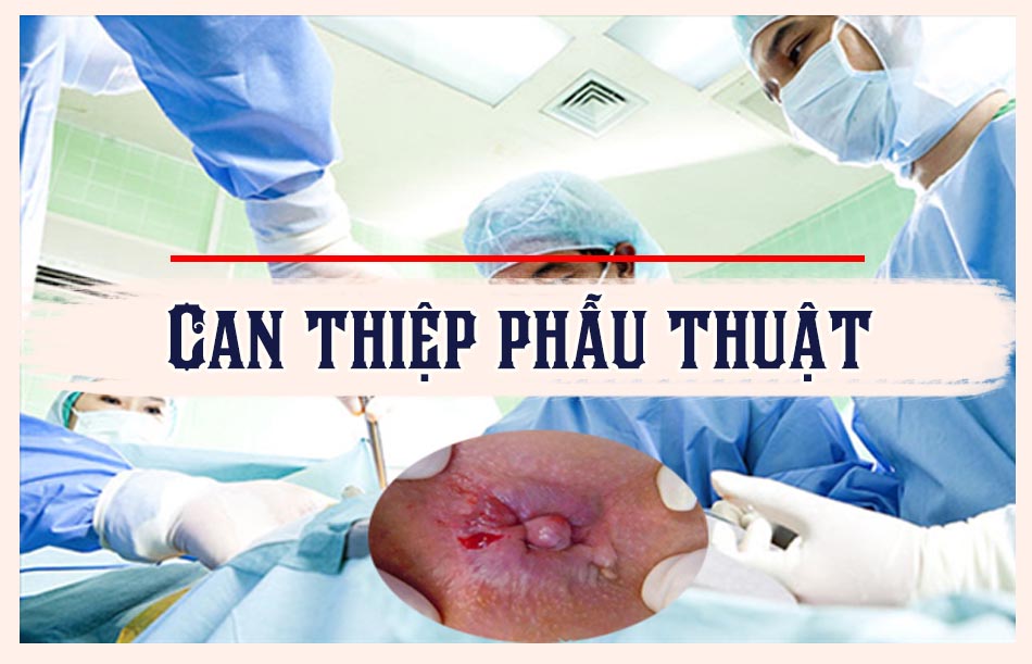 Hoặc nhờ can thiệp của phẫu thuật