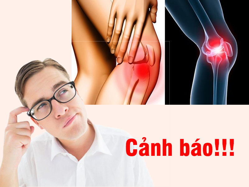 Đau khớp gối cảnh báo bệnh lý gì?