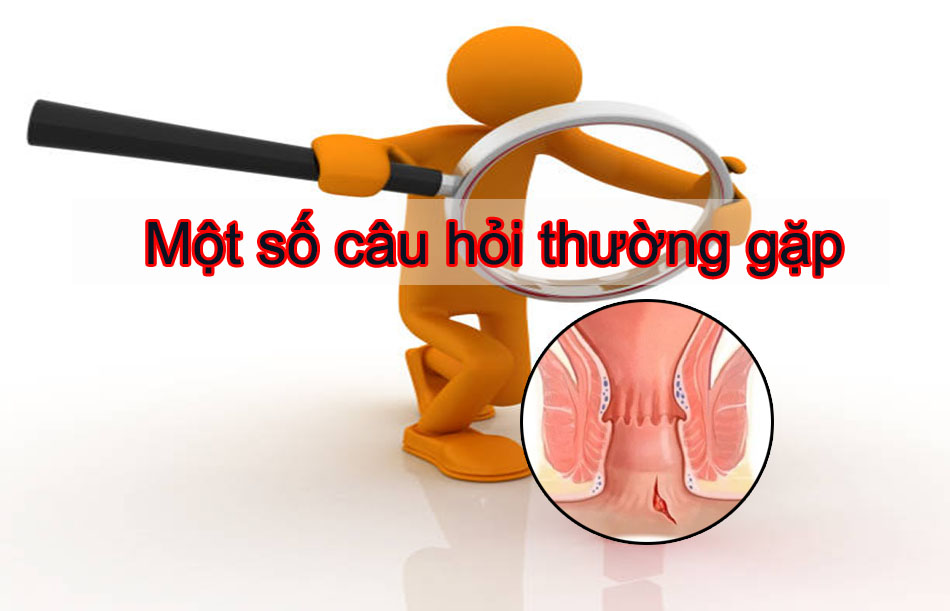 Một số câu hỏi