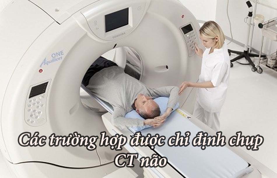Chỉ định chụp CT não