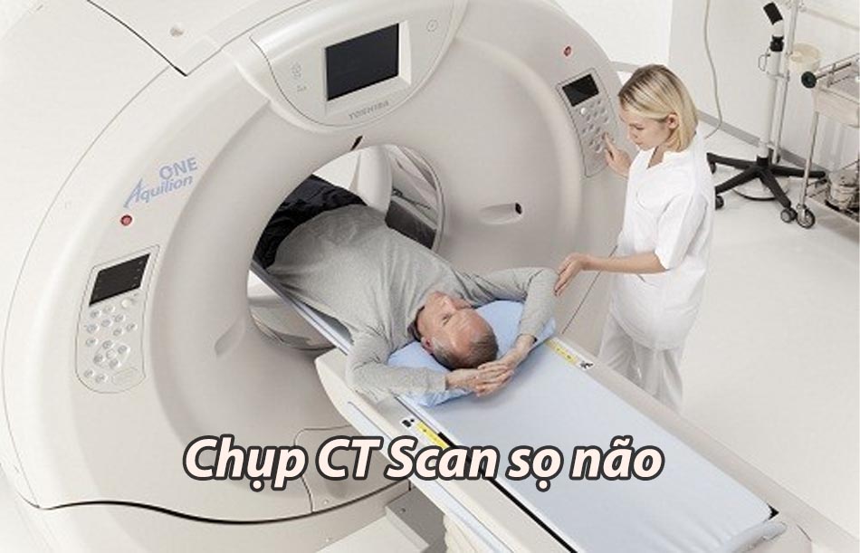 Chẩn đoán phình mạch máu não