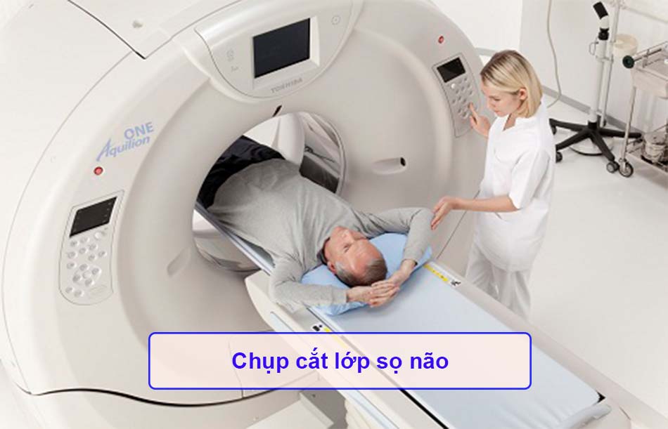 Chụp cắt lớp sọ não