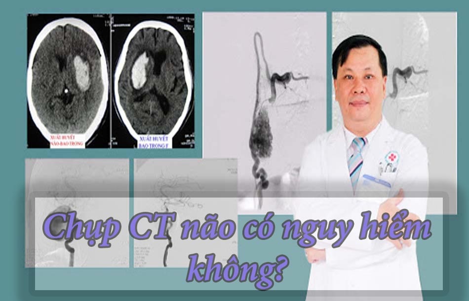 Chụp CT có nguy hiểm không