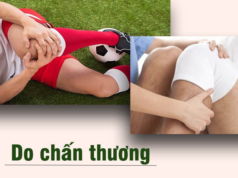 Do chấn thương khớp gối