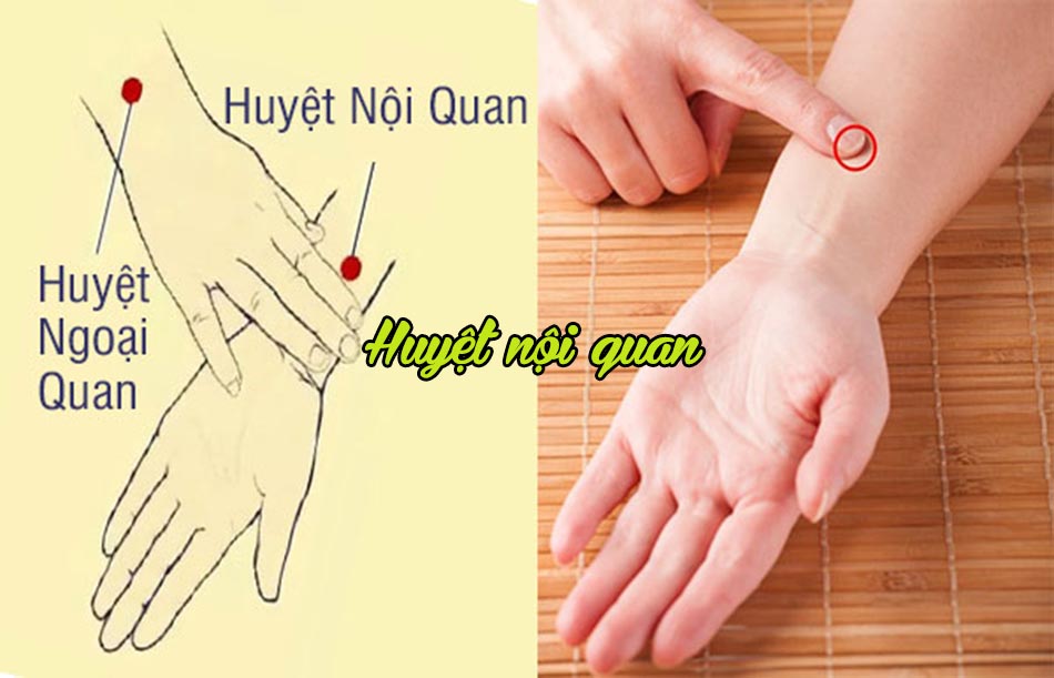 Huyệt nội quan