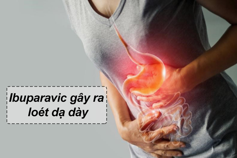 Sử dụng Ibuparavic gây ra loét dạ dày