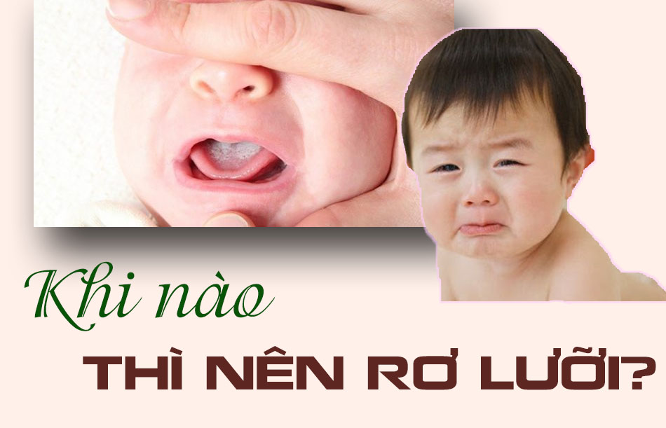 Khi nào nên rơ lưỡi cho trẻ?