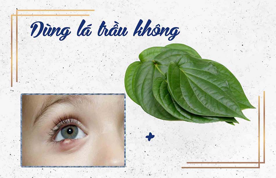 Dùng lá trầu không chữa lẹo mắt