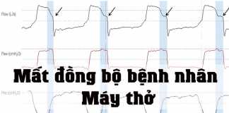 Mất đồng bộ bệnh nhân - Máy thở