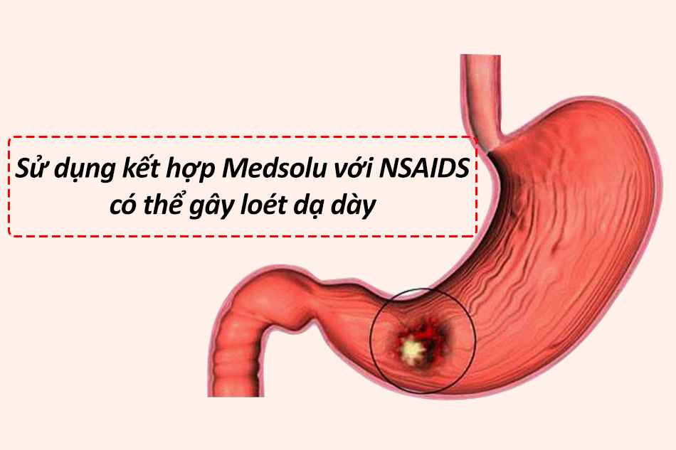 Sử dụng kết hợp Medsolu với NSAIDS có thể gây loét dạ dày