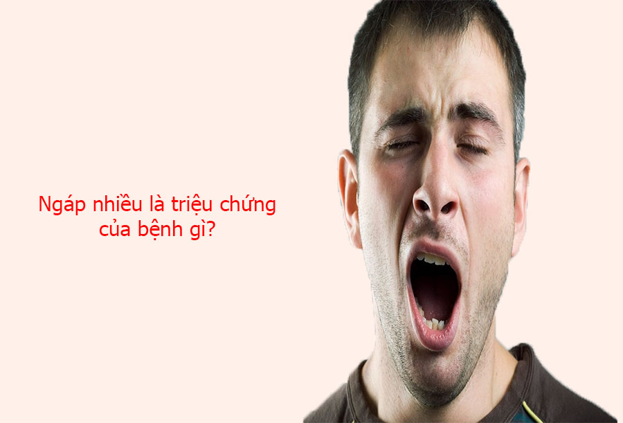 Ngáp nhiều là triệu chứng của bệnh gì?