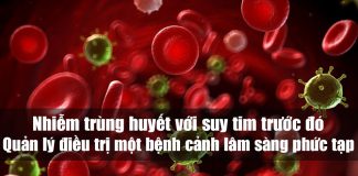 Nhiễm trùng huyết với suy tim trước đó: Quản lý điều trị một bệnh cảnh lâm sàng phức tạp