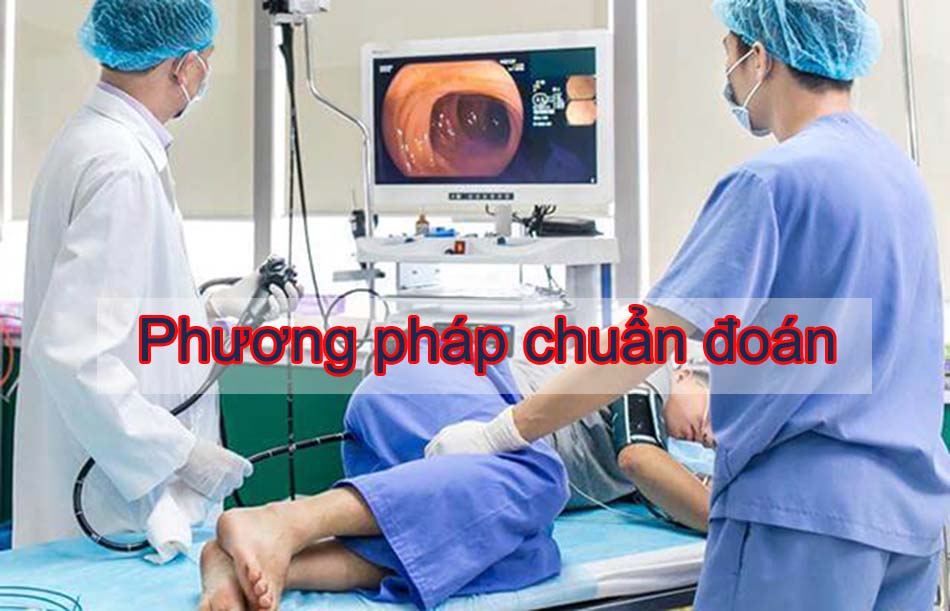 Phương pháp chuẩn đoán nứt kẽ hậu môn