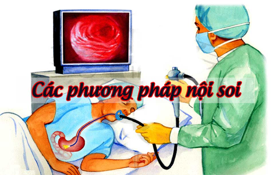 Các phương pháp nội soi hiện nay