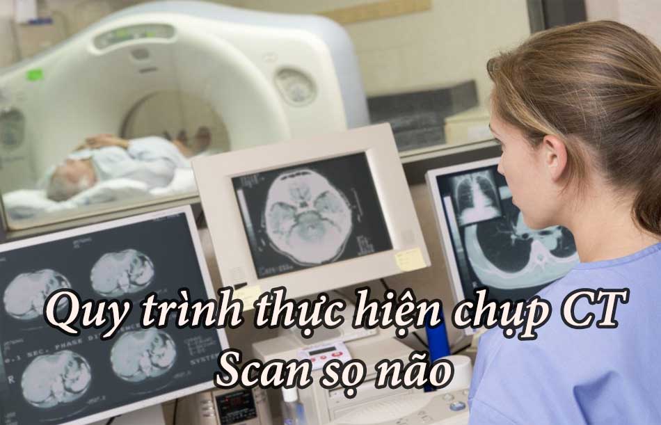 Quy trình thực hiện chụp CT Scan sọ não