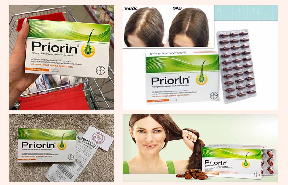 Review về sản phẩm Priorin