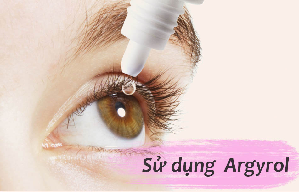 Cách sử dụng thuốc nhỏ mắt Argyrol