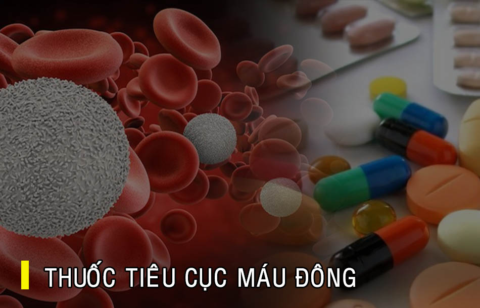 Thuốc tiêu cục máu đông thường được chỉ định trong các trường hợp tai biến mạch máu não