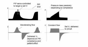 Hình 1 Với thông khí kiểm soát áp lực (hình bên trái), biến kiểm soát chính là áp lực hít vào.