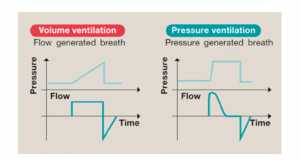 Hình 3. Các dạng sóng áp lực và lưu lượng trong thông khí kiểm soát thể tích (VC) và kiểm soát áp lực (PC). Hàng trên là dạng sóng áp lực và hàng dưới là dạng sóng lưu lượng trong thì hít vào. Trong VC, lưu lượng là hằng định trong thì hít vào để áp lực tăng lên trong thời gian, và là tối đa ở cuối thì hít vào. Trong VG, lưu lượng khí là tối đa ở đầu nguồn thì hít vào để áp lực đỉnh đạt được sớm và được duy trì trong suốt thì hít vào.