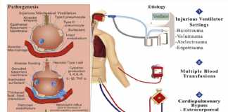 Thông khí xâm lấn bảo vệ trong phẫu thuật tim