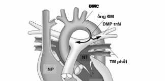 Đại cương tim học mạch sơ sinh