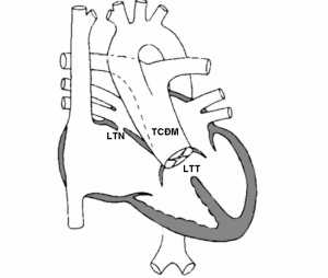 Hình 9: Thân chung động mạch.