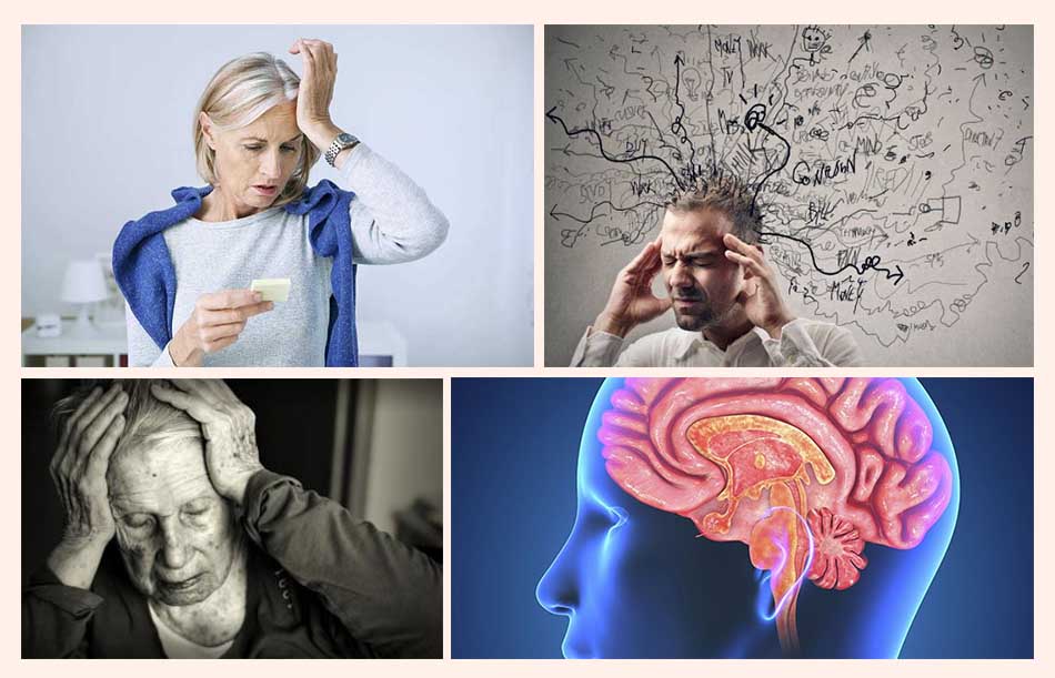 Triệu chứng điển hình của bệnh Alzheimer