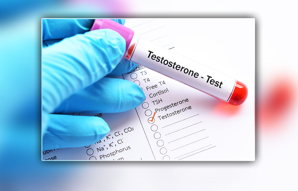 Xét nghiệm nồng độ Testosterone để chẩn đoán yếu sinh lý