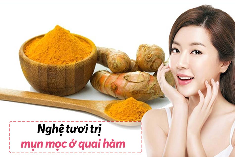 Trị mụn quai hàm bằng nghệ tươi