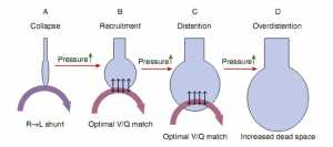 Hình 1-4 Nguyên tắc cơ bản của việc huy động dưới hướng dẫn của oxygen hóa, minh họa bởi một đơn vị mao mạch-phế nang.