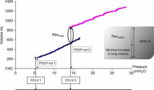 Hình 2. Ví dụ về đường cong áp suất – thể tích (P-V) từ một bệnh nhân đại diện ở hai mức PEEP khác nhau (dòng màu đen PEEP = 5 cm H2O và đường màu xám PEEP = 14 cm H2O).