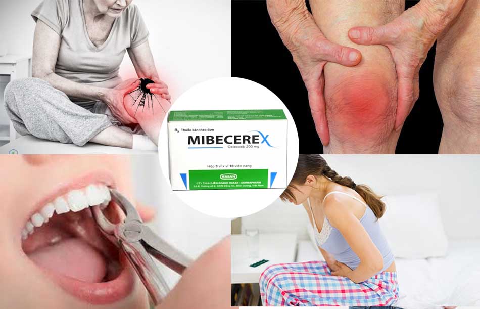 Chỉ định của thuốc Mibecerex